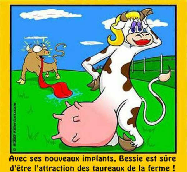 implants-2-humourenvrac