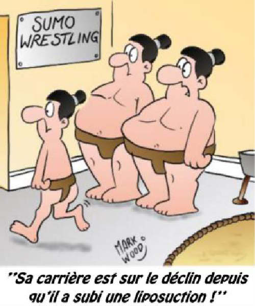 liposuction-humourenvrac