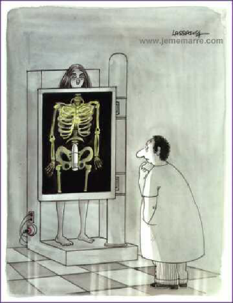 radio_vibromasseur-HeV